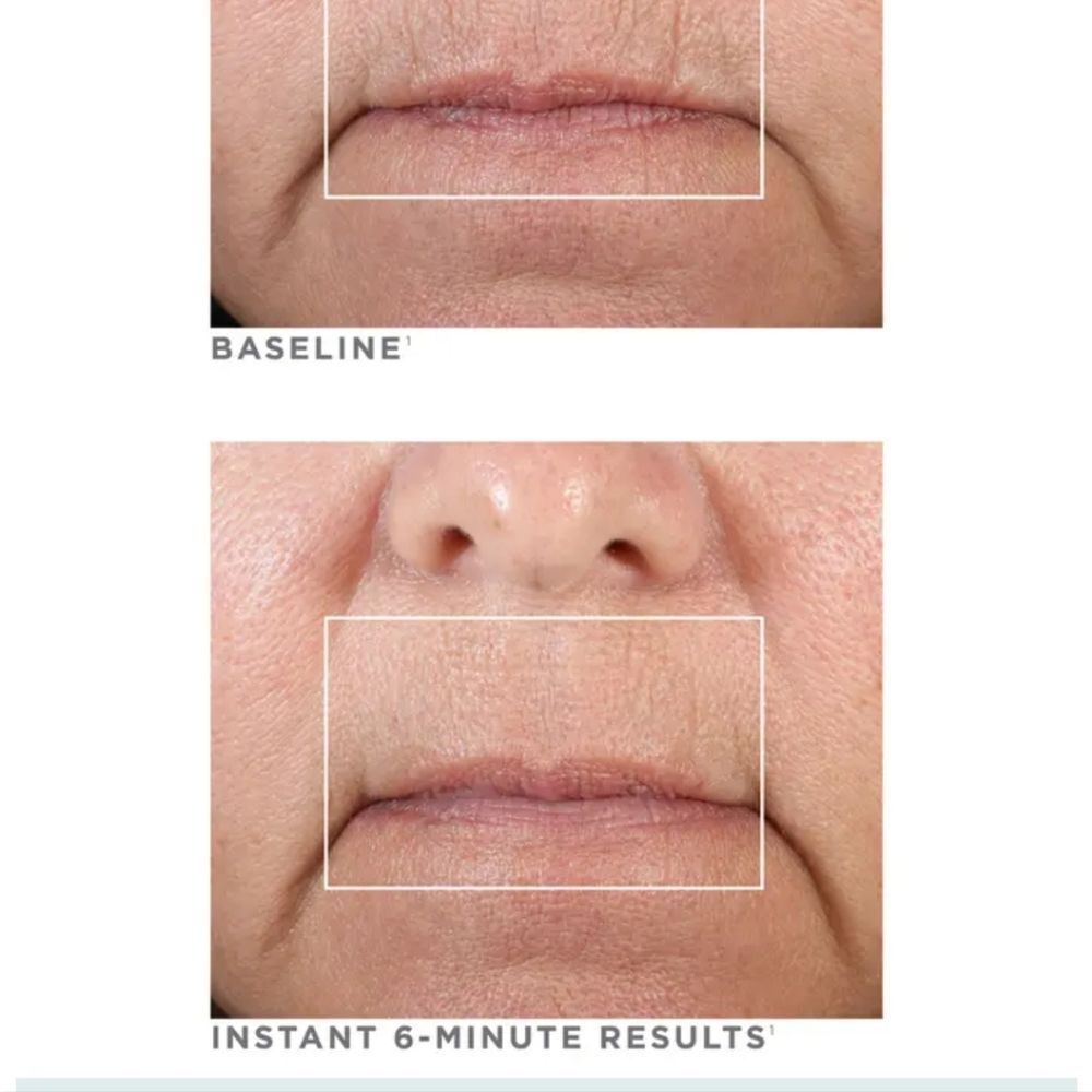 NuFace‎ Fix Line Smoothing Device - Picture 8 of 12